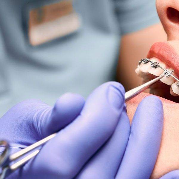 m/ارتودنسی دندان چیست؟