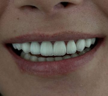 بریج برای چه کسانی مناسب است
